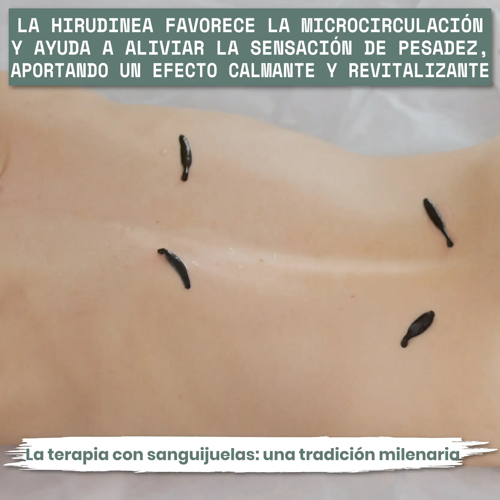 Hirudine Cream - Imagen 4